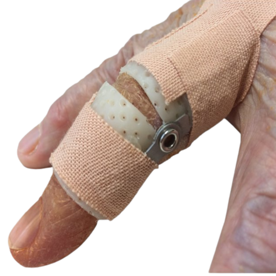 Dynamic Individual Finger Splint Dp Pip Pes Planus