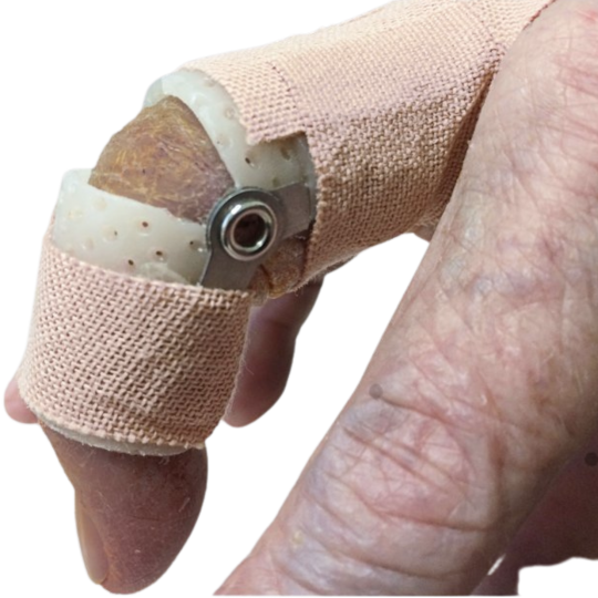 Dynamic individual finger splint DPĮ PIP Pes Planus